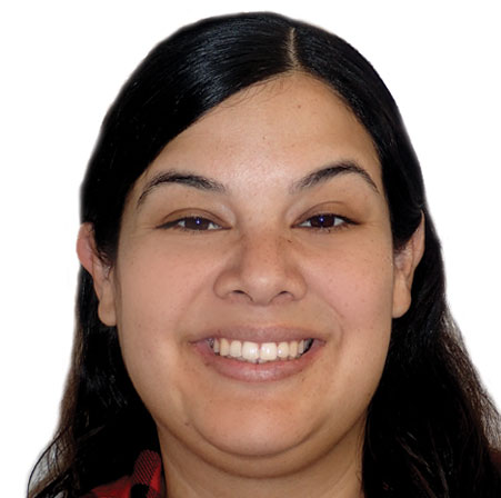 Adult-Braces-Krystle-Gonzalez-Face-After.jpg