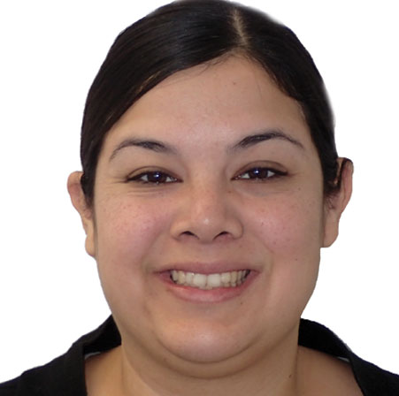 Adult-Braces-Krystle-Gonzalez-Face-Before