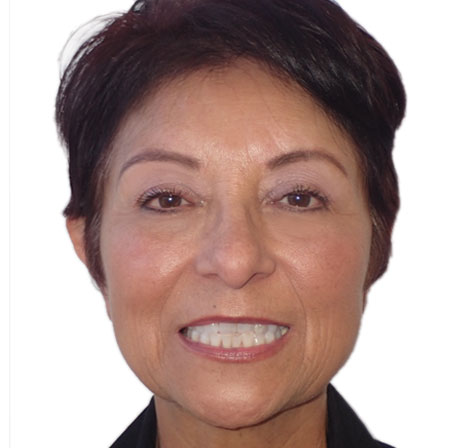 Adult-Invisalign-Cecilia-Reyna-Face-Before