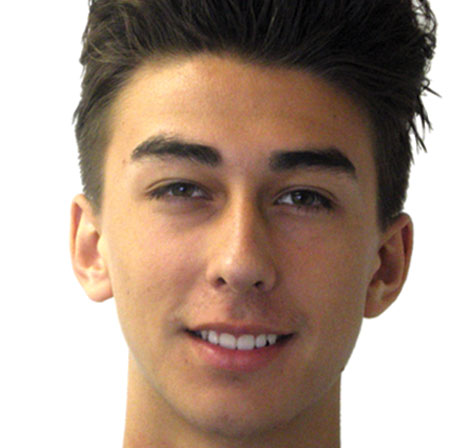 Teen-Invisalign-Reyce-Holguin-Face-Before