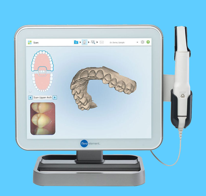 iTero Intraoral Scanner